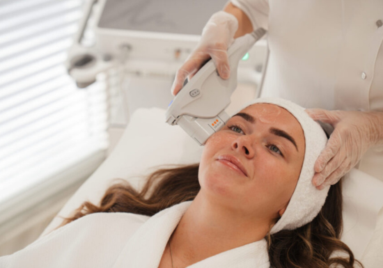 Ultherapy PRIME Treatment